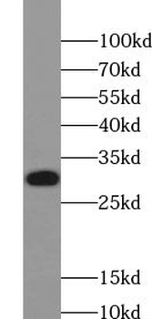 VPS28 Rabbit Polyclonal Antibody