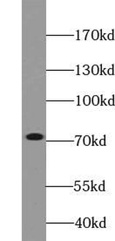 VPS33B Antibody