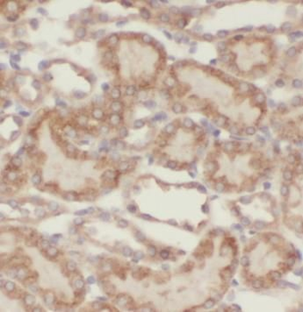 VPS33B Antibody