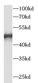 VPS37A Rabbit Polyclonal Antibody