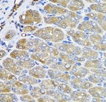 VPS37A Rabbit Polyclonal Antibody