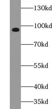 VPS41 Rabbit Polyclonal Antibody
