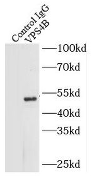 VPS4B Antibody
