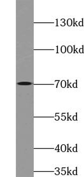 VSX1 Rabbit Polyclonal Antibody