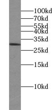 VTI1A Rabbit Polyclonal Antibody