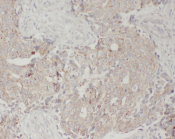 WDFY3 Rabbit Polyclonal Antibody