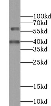 WDR13 Rabbit Polyclonal Antibody