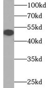 DCAF12 Rabbit Polyclonal Antibody
