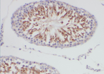 DCAF12 Rabbit Polyclonal Antibody