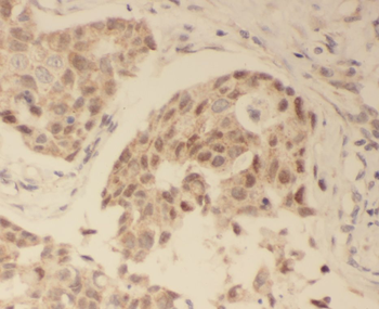 SKIC8 Rabbit Polyclonal Antibody