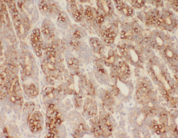 WDR7 Rabbit Polyclonal Antibody