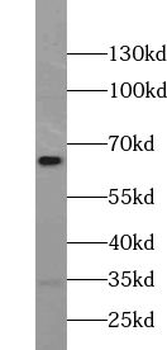 WEE2 Rabbit Polyclonal Antibody