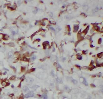 WNT3A Rabbit Polyclonal Antibody