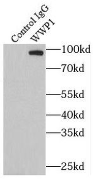 WWP1 Rabbit Polyclonal Antibody