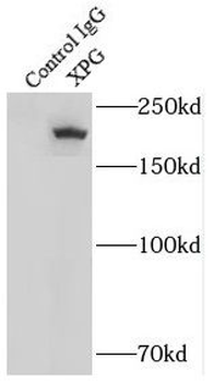 ERCC5 Rabbit Polyclonal Antibody