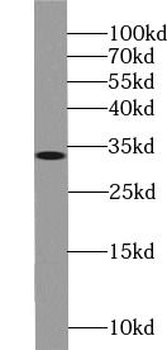 XRCC2 Rabbit Polyclonal Antibody