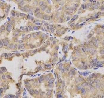 XRCC2 Rabbit Polyclonal Antibody