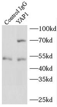 YAP1 Rabbit Polyclonal Antibody