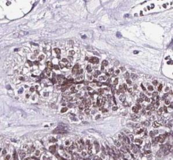 YAP1 Rabbit Polyclonal Antibody