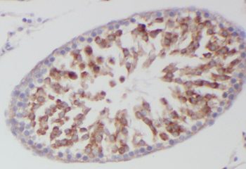 YARS2 Rabbit Polyclonal Antibody