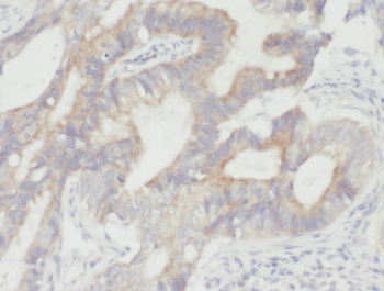 YME1L1 Rabbit Polyclonal Antibody