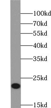 YPEL1 Rabbit Polyclonal Antibody