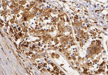 ZBP1 Rabbit Polyclonal Antibody