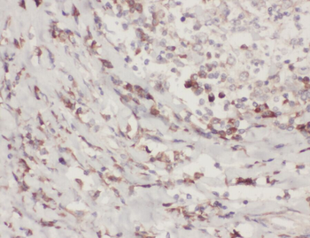 ZC3H4 Rabbit Polyclonal Antibody