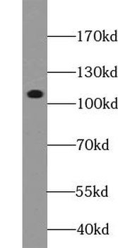 ZC3H7B Antibody