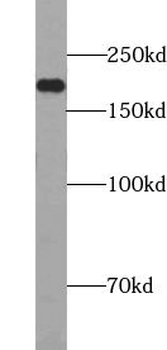 TUT4 Rabbit Polyclonal Antibody