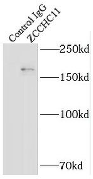 TUT4 Rabbit Polyclonal Antibody