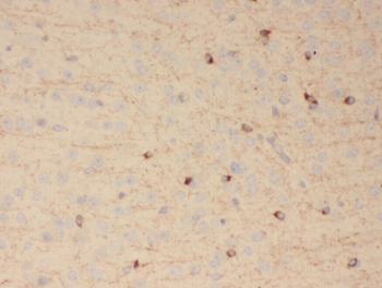 TUT4 Rabbit Polyclonal Antibody