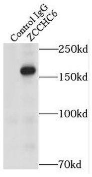 TUT7 Rabbit Polyclonal Antibody