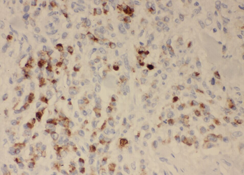 ZDHHC13 Rabbit Polyclonal Antibody