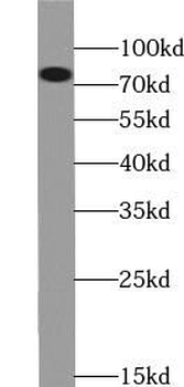 ZDHHC5 Rabbit Polyclonal Antibody