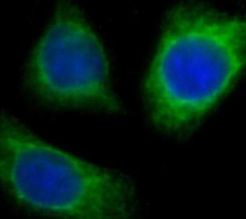 ZDHHC5 Rabbit Polyclonal Antibody