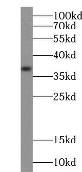ZDHHC9 Rabbit Polyclonal Antibody