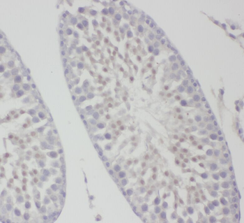 ZDHHC9 Rabbit Polyclonal Antibody