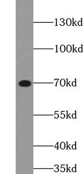 ZFP64 Rabbit Polyclonal Antibody