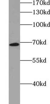 ZFP90 Rabbit Polyclonal Antibody