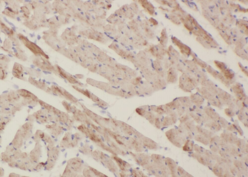 ZFYVE19 Rabbit Polyclonal Antibody
