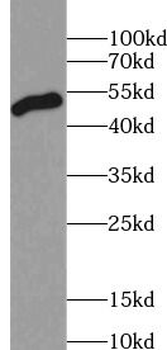 ZFYVE27 Rabbit Polyclonal Antibody