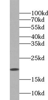 ZG16 Rabbit Polyclonal Antibody