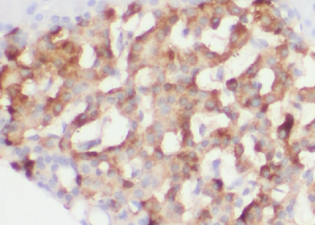 ZG16 Rabbit Polyclonal Antibody