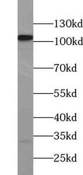 ZHX1 Rabbit Polyclonal Antibody