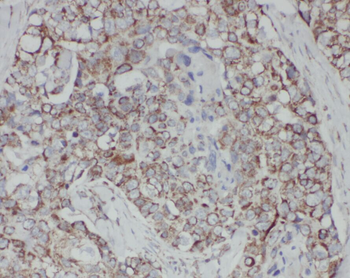 ZHX1 Rabbit Polyclonal Antibody