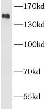 ZMYND8 Rabbit Polyclonal Antibody