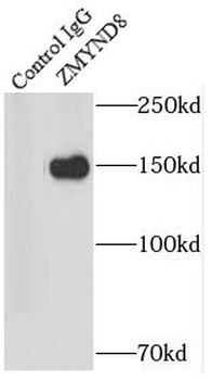 ZMYND8 Rabbit Polyclonal Antibody
