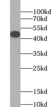 ZNF114 Rabbit Polyclonal Antibody