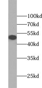 ZNF2 Rabbit Polyclonal Antibody